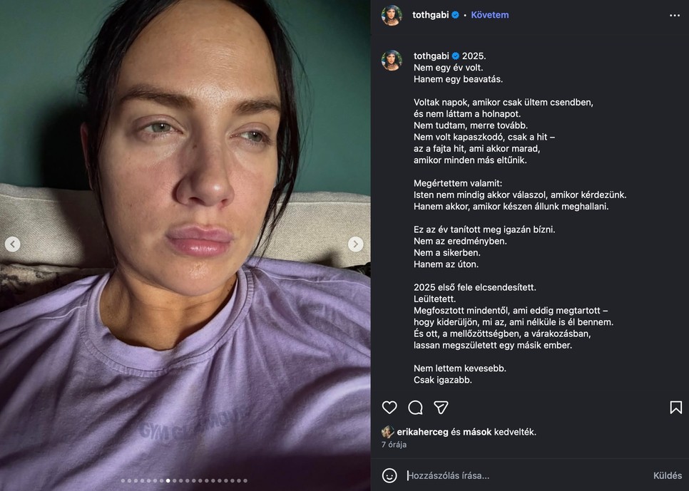 Tóth Gabi smink nélküli fotója nagy sikert aratott