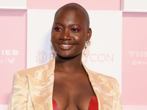 Tragédia! Váratlanul, 30 évesen hunyt el a ráktúlélő, aktivista modell