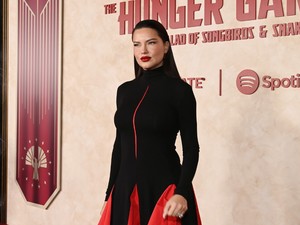 Adriana Lima reagált az arcáért aggódó rajongóinak