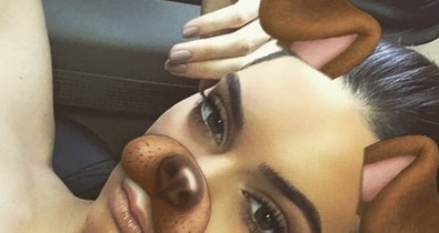 Ijesztő trend: plasztikai beavatkozás, hogy jobban hasonlíts a Snapchat képekre