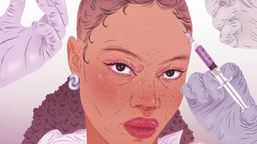 Hatékony és korszerű megoldás hajhullás ellen - ismerd meg a fejbőr injekciózás hatásait