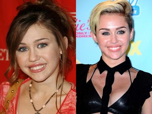 Előtte-utána: sztárok, akik megcsináltatták a fogukat