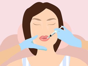 Ajakfeltöltésen gondolkozol? Minden, amit előbb tudnod kell róla