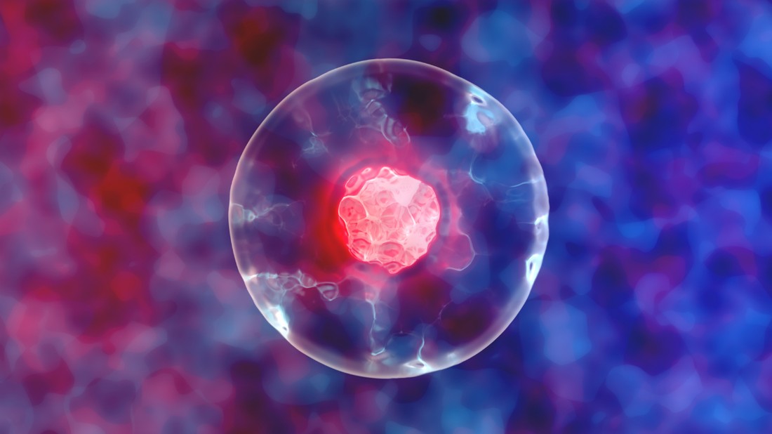 Az őssejttel történő gyógyítás Magyarországon még nem bevett szokás, a nyugati orvoslás viszont az utóbbi harminc évben komolyan foglalkozik a témával