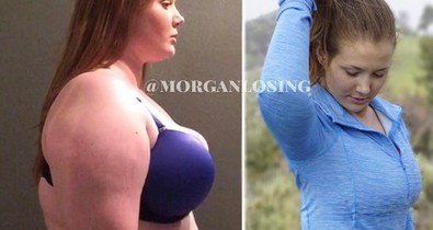 Törölték ennek a lánynak a fotóját - Miért nem tetszik az Instagramnak a fogyás?