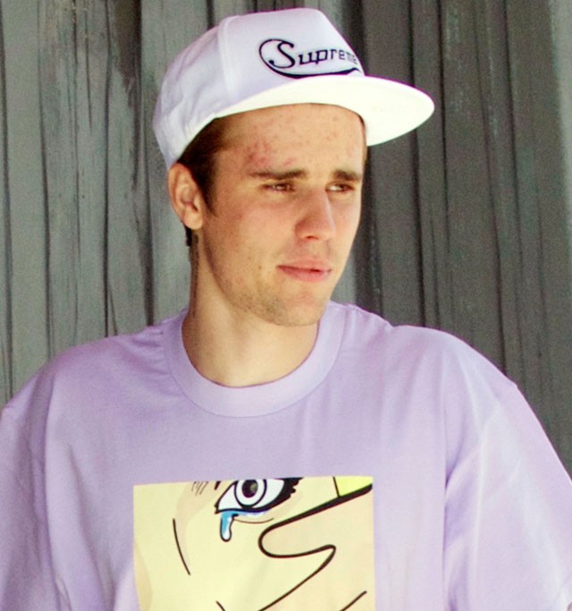 Egyre extrémebb: Justin Bieber fogékszert és új piercinget csináltatott