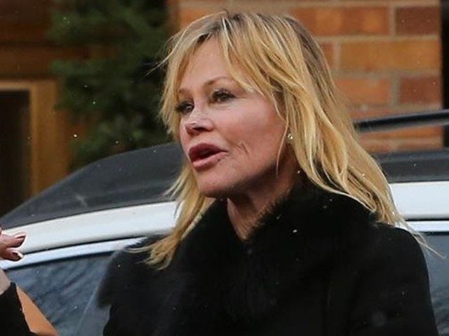 Jaj: a 90-es évek szexszimbóluma túltolta a plasztikát, már felismerhetetlen