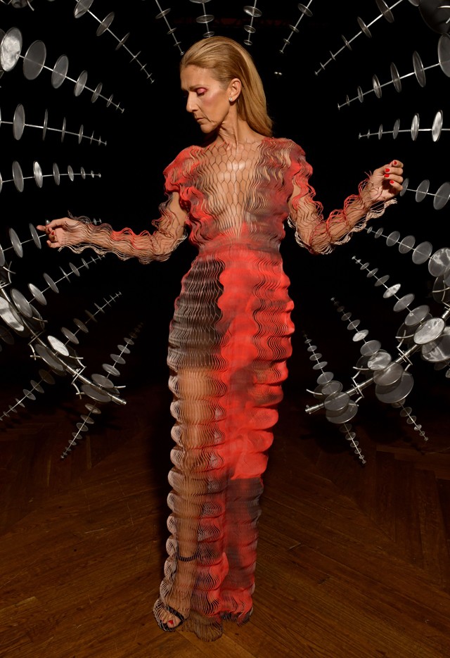 Celine Dion ruhája tudatmódosító szerként hat az agyra: szédülés garantált