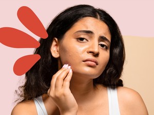 Ezt műveli bőröddel a stressz: szakértő világított rá a problémára