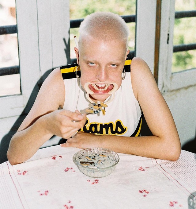 Megrázóan őszinte fotósorozat készült a kinézetükért kiközösített emberekről!