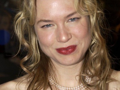 Mindig meglepődünk, mennyire felismerhetetlen Renee Zellweger a sok plasztikától