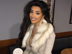 Sokkolóan őszinte fotókat osztott meg orrplasztikájáról a modell!