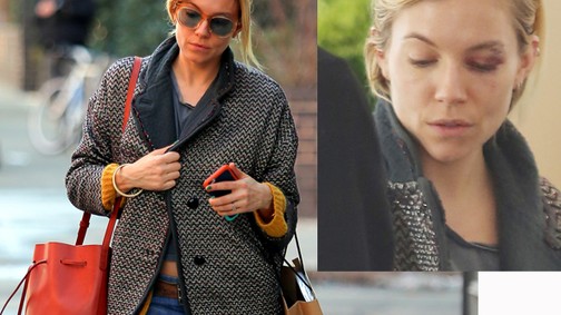 Sienna Miller óriási monoklival