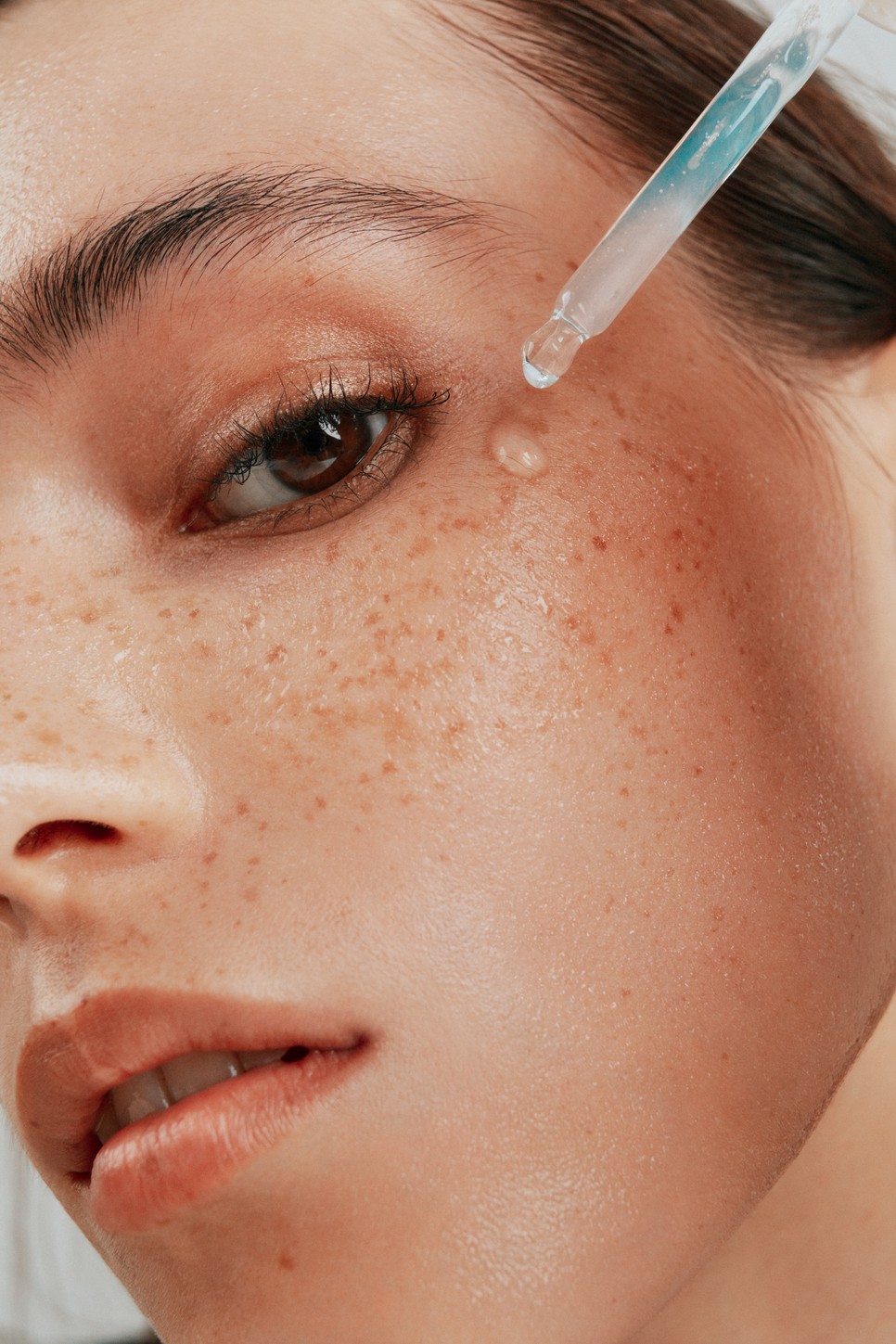 Amikor új kémiai hámlasztó kerül rutinodba, figyeld arcbőröd reakcióit!