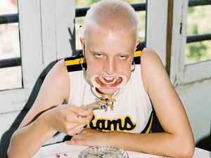 Megrázóan őszinte fotósorozat készült a kinézetükért kiközösített emberekről!