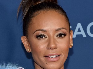 Mel B arca már teljesen felismerhetetlen a sok botoxtól