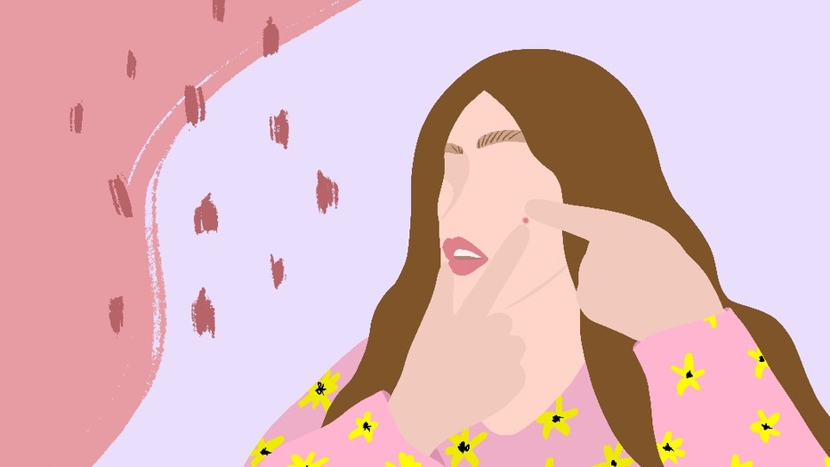 Így kezeld hatékonyan a pattanásokat: 5 tipp a tiszta bőrért