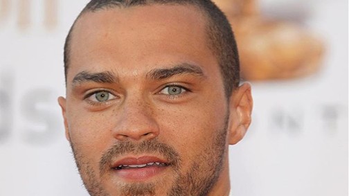 A Grace klinika szexi sztárja egyre rosszabbul néz ki! Mi történik vele?