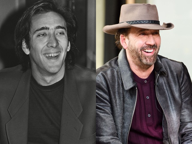 Előtte-utána: sztárok, akik megcsináltatták a fogukat