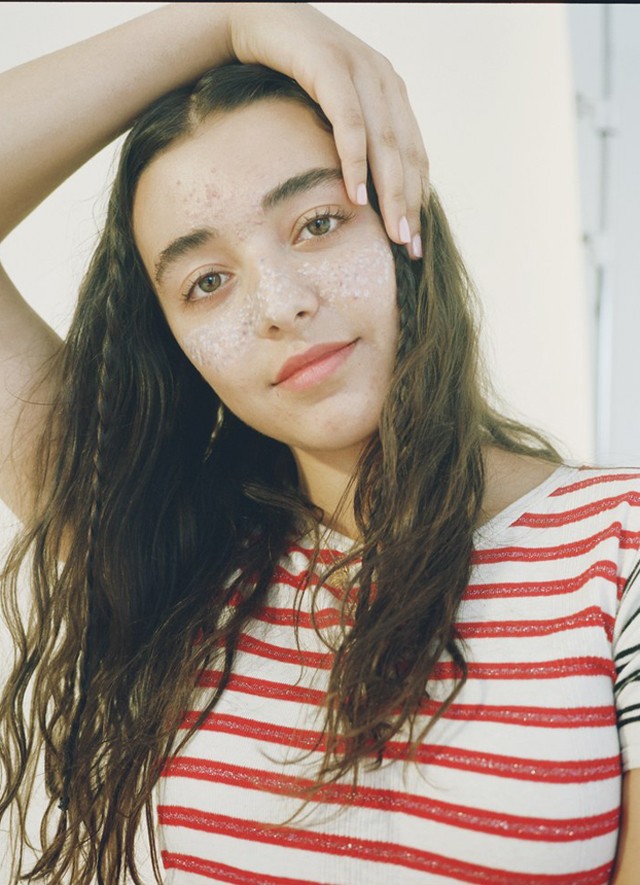 Ez a két művész nem eltünteti, hanem kiemeli a pattanásokat