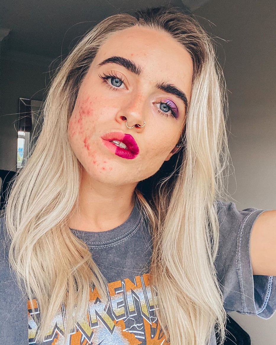 7 alapvető hiba, ami a problémás bőr fő okozója is lehet