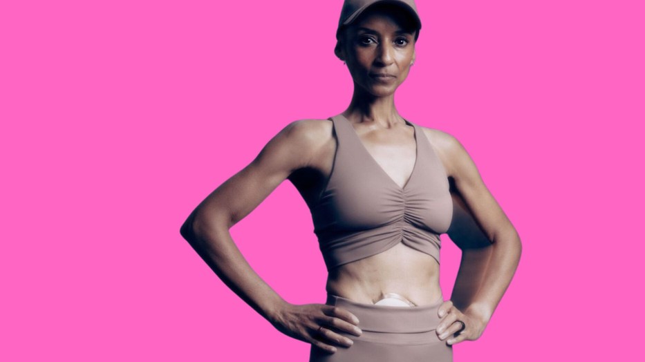 Adele tehetséges futó, aki nyíltan dokumentálta sportolói pályafutását a rákbetegséggel és a sztómával kapcsolatos tapasztalatai során. Adele jelenleg világrekorder maratonfutásban a sztómával élő sportolók között