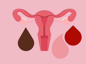 Ezt próbálja jelezni neked a menstruációs vérzésed színe az egészségedről