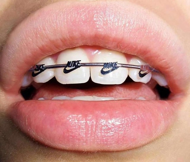 Megtanítunk: így kell kiejteni a világmárkák nevét