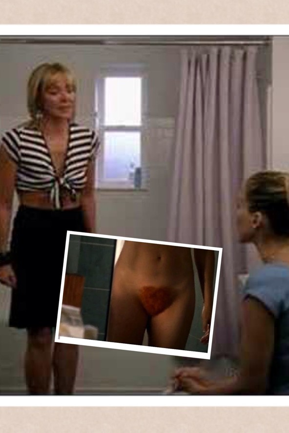 Nők, akik intimszőr-beültetést kérnek