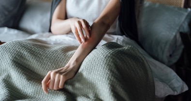 Vigyázz: ha ezt teszed, jobban vonzod a szúnyogokat