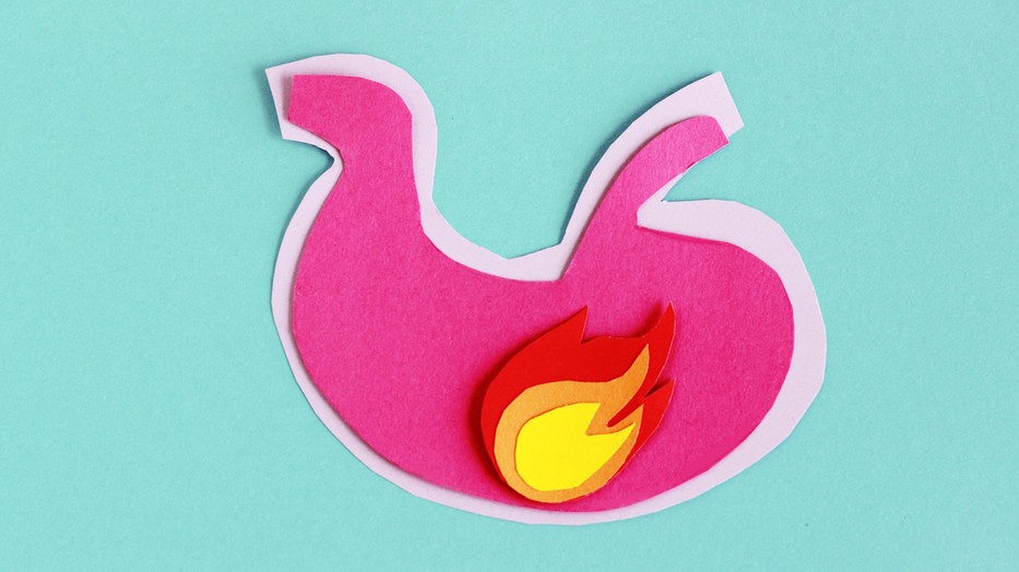 Te is refluxos vagy? Nem vagy egyedül!