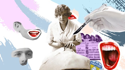 A nő, aki szép arccal és zsírleszívással támogatta társait - Ő Suzanne Noël, a világ első női plasztikai sebésze