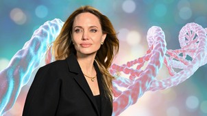 Angelina Jolie egy DNS-vizsgálat miatt vetette le a melleit, de a szakember szerint ne rohanjunk egyből teszteltetni