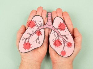 A tüdőrák 6 jele, amit minden embernek ismernie kellene