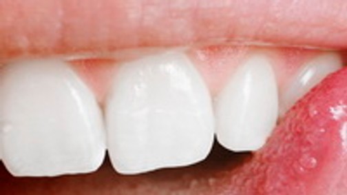 Rossz fogak számos betegség hátterében