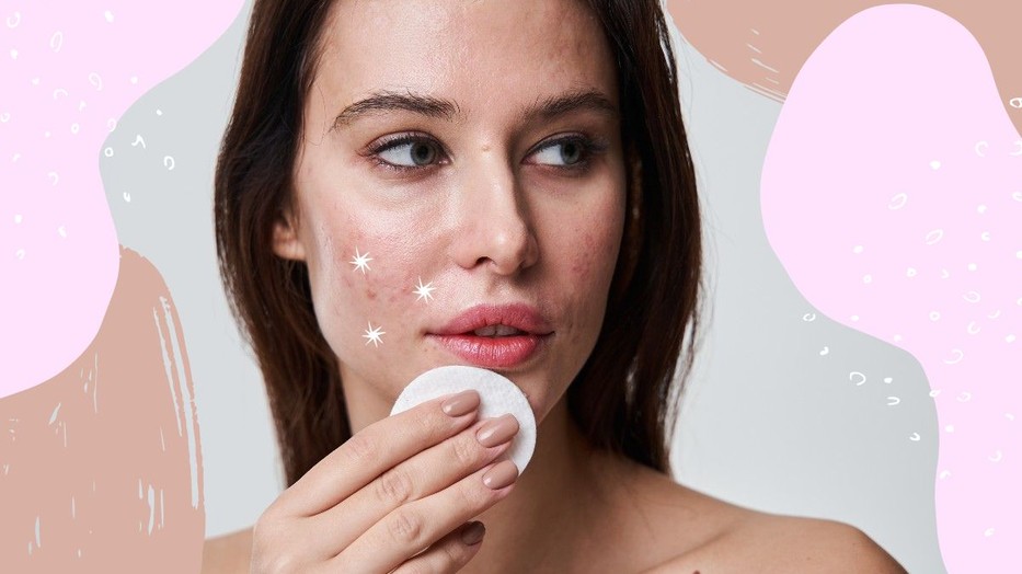 Jó, ha tudod, mi a különbség a pattanás és a furunkulus között, így nem teszel kárt a bőrödben