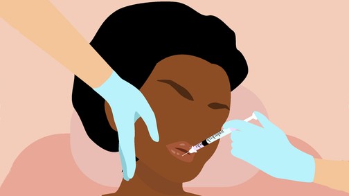 10+1 kérdés, amit tegyél fel a bőrgyógyásznak, mielőtt belevágnál az arc- és szájfeltöltésbe