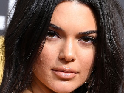 5 természetes gyógymód az akné kezelésére