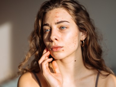 Végre itt a magyarázat: ez a bőrprobléma okozza a legtöbb mentális problémát