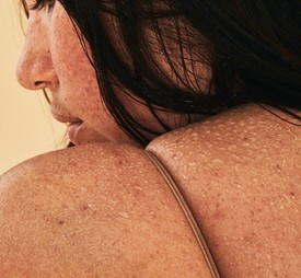 Újabb kampány adja tudtunkra, hogy narancsbőrrel, szeplőkkel, ráncokkal együtt vagyunk gyönyörűek