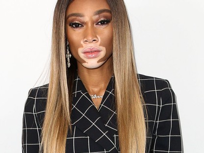 Rá sem ismerünk! Winnie Harlow élete legvisszafogottabb szettjét láthatod! 
