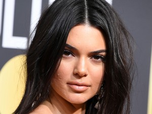 5 természetes gyógymód az akné kezelésére