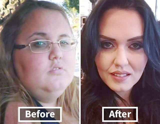 Így változik az ember arca a fogyástól! *Megdöbbentő előtte-utána fotók!*