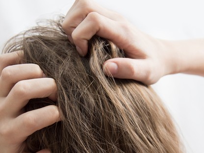 Rettenetesen viszket a fejbőröd? Ez lehet akár ekcéma is