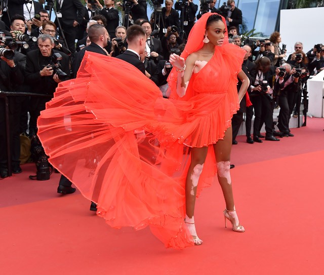 Winnie Harlow akkorát villantott, hogy oda sem merünk nézni, de még így is látjuk...