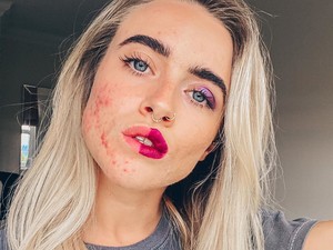 7 alapvető hiba, ami a problémás bőr fő okozója is lehet