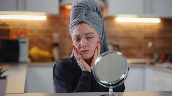 Ezt teszi a stressz a bőröddel - 5 tipp, hogy elfelejtsd a stressz okozta bőrproblémákat - Glamour