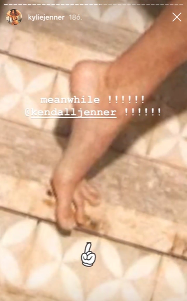 Végre kiderült, hogy miért olyan furcsa Kylie Jenner lábujjja