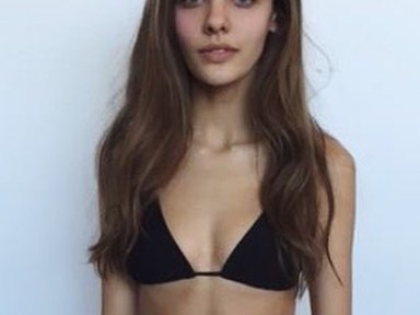 Elképesztő! 15 kg-ot hízott a modell alkatú lány és így vált igazi bombázóvá!