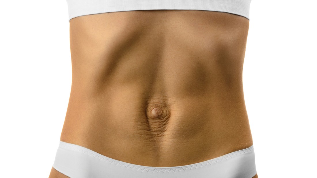 A szétnyílt hasizom megfelelő életmóddal helyrehozható Pintér Ada szerint